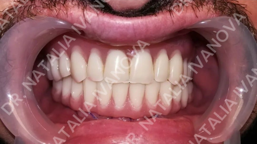 cc3