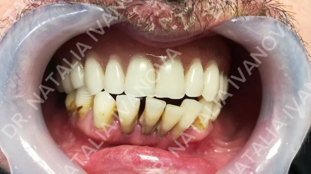 cc4