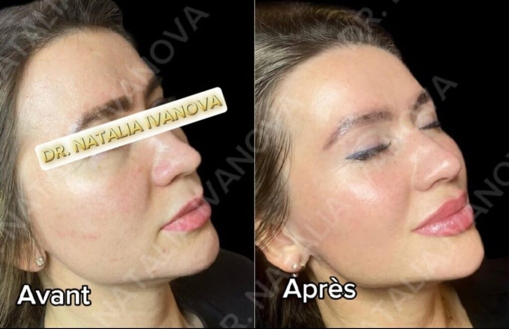 collagen