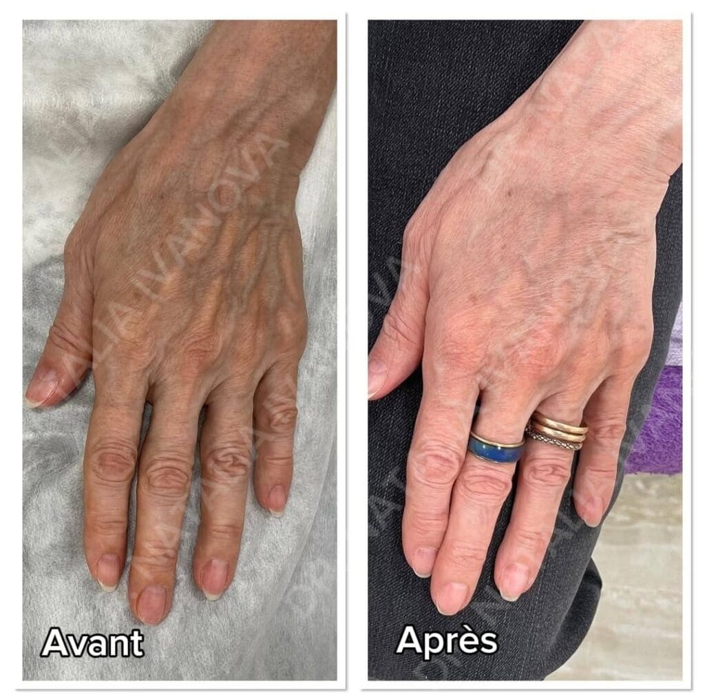 collagen2